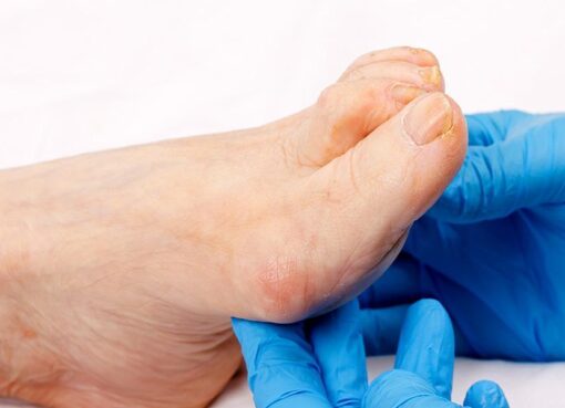 Podiatry Crucial