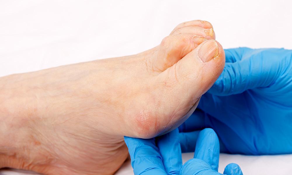 Podiatry Crucial