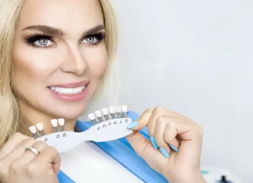 Dental Veneers